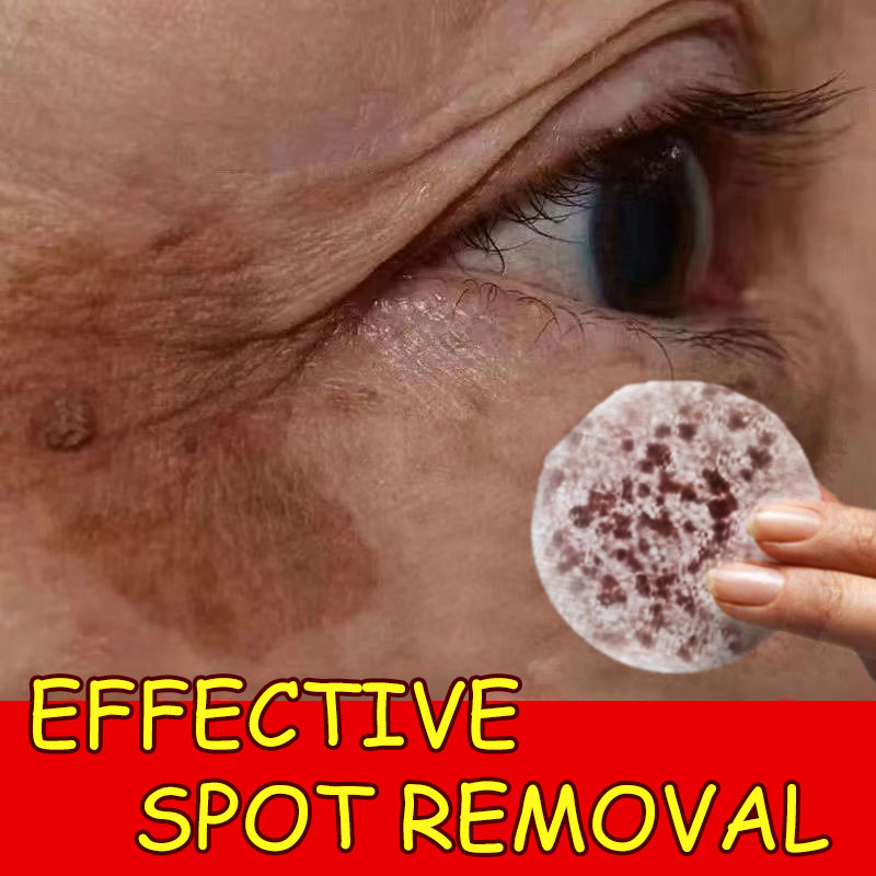 Freckle Removal [100%Natural] 美白精华 dark spot remover moisturizing lifting and serum for face dark spot and not irritating acne treatment wrinkle remover make the skin elastic 30ml